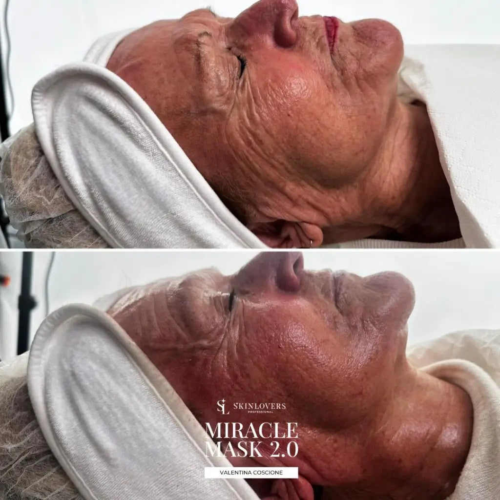 Bundle Miracle Mask 2.0