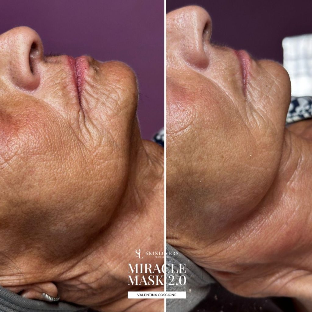 Bundle Miracle Mask 2.0