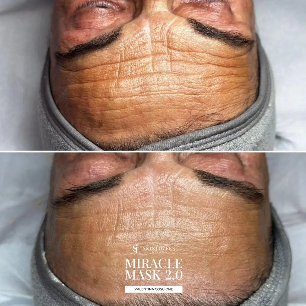 Bundle Miracle Mask 2.0