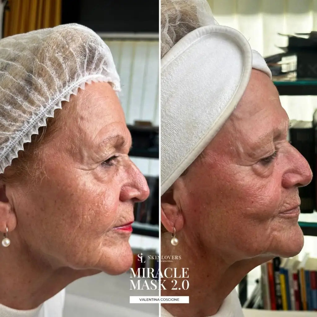 Bundle Miracle Mask 2.0